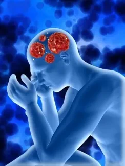 اعراض نزيف المخ الداخلي